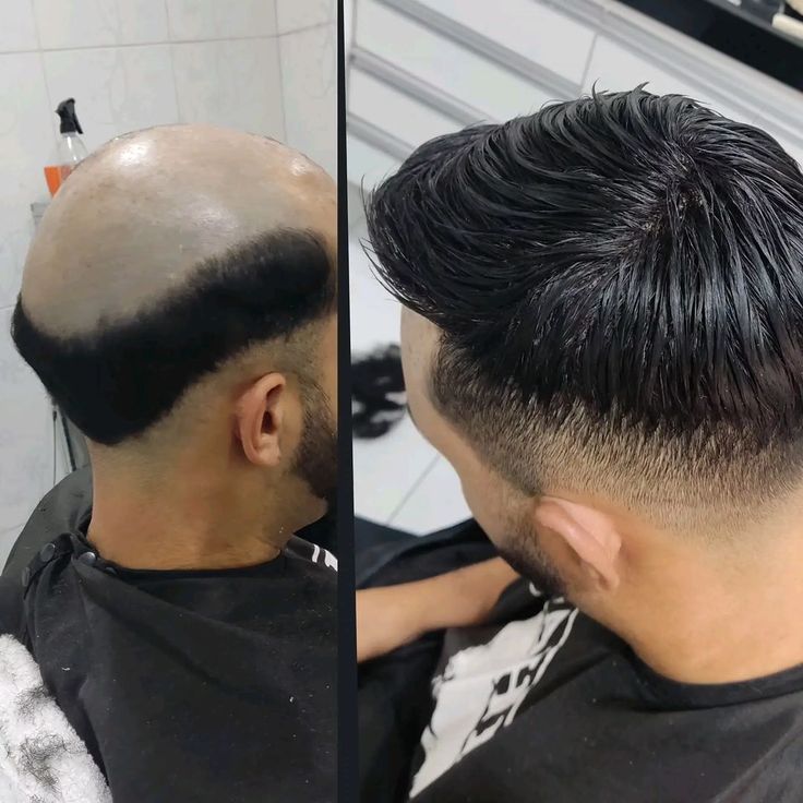 بروكة شعر
